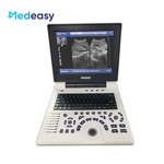 Portable Wireless Ultrasound Manufacturer - Hot Selling Mini 2 in 1 Custom