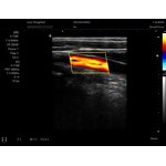 Laptop Ultrasound Scanner Factory - New B/W Device Portable with PW/ IMT