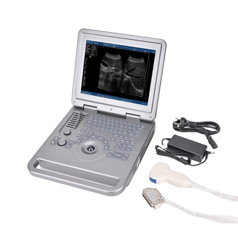Black White Ultrasound Machine Supplier - 12inch Laptop with Convex Probe