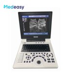 Portable Wireless Ultrasound Manufacturer - Hot Selling Mini 2 in 1 Custom