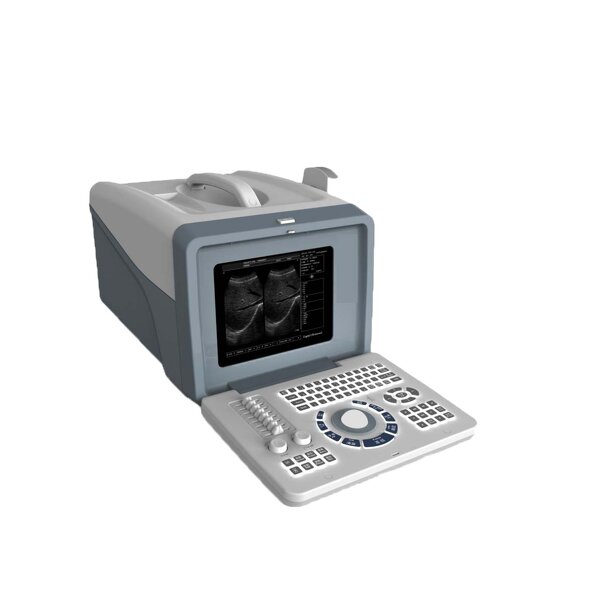 Handheld Ultrasound Factory - Durable Low Price Full Digital Portable