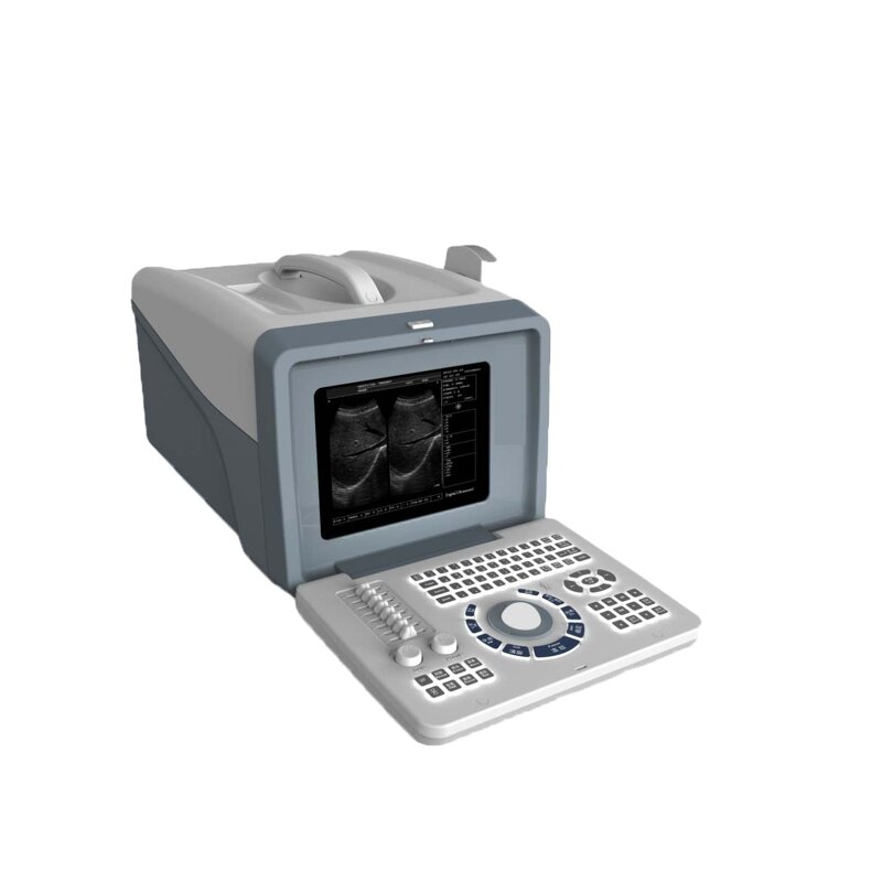 Handheld Ultrasound Factory - Durable Low Price Full Digital Portable