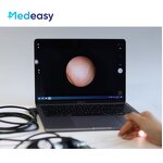 Medical Endoscope HD USB Camera Factory - 1080P for Surgery Endoscopic