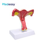 Female Uterus Anatomical Model Manufacturer - Vagina Model Plastic Uterus Normal