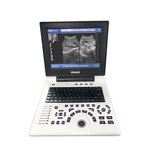 Portable B Ultrasound Scanner Supplier - 12 Inch LED Laptop Full Digital