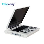 Portable B Ultrasound Scanner Supplier - 12 Inch LED Laptop Full Digital