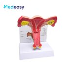 Female Uterus Anatomical Model Manufacturer - Vagina Model Plastic Uterus Normal
