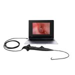 Flexible Rhinolaryngoscope Supplier - 3mm Reusable ENT Laryngoscope with USB