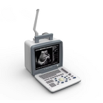 Pocket Portable Ultrasound Manufacturer - Special Design Full Digital LED
