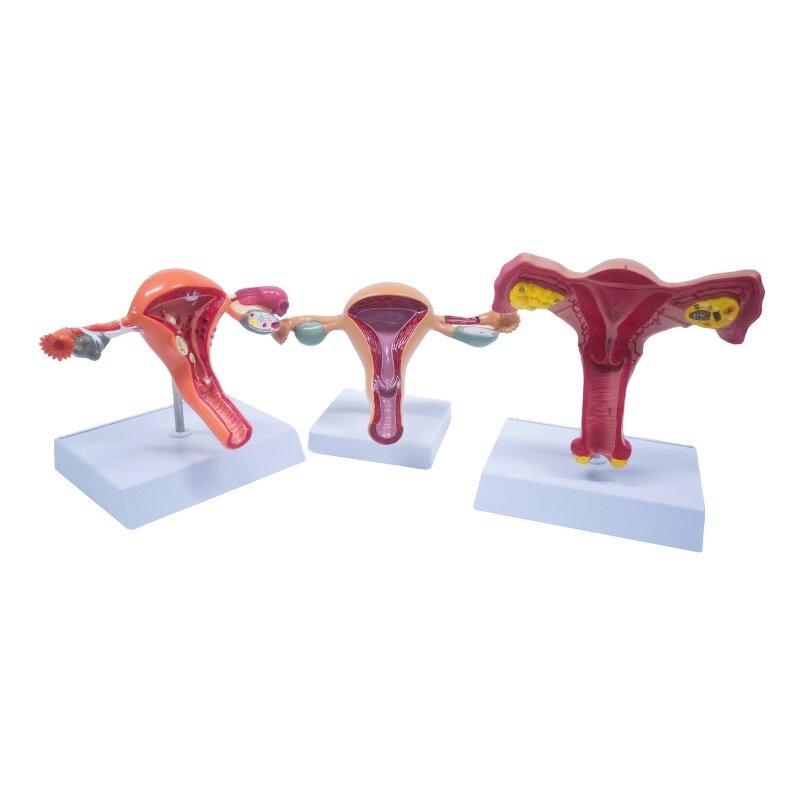 Female Uterus Anatomical Model Manufacturer - Vagina Model Plastic Uterus Normal
