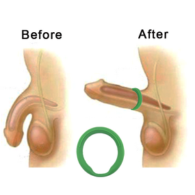 Health Enlargement Penis Ring Manufacturer - Silicone Sex Power Cock Rings Quantum
