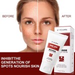 Factory OEM ODM Private Label Whitening Freckle Dark Spots Brightening Skin Arbutin Niacinamide Lighten Face Cream