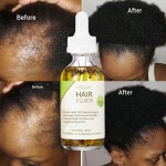 Private Label OEM 100% Natural Formula Wholesale Nourishing Hair Care Loss Treatment Hair Growth Oil Serum