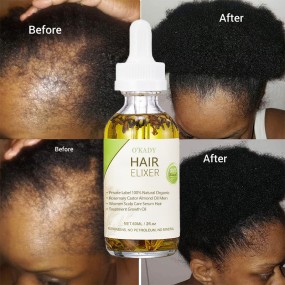 Private Label OEM 100% Natural Formula Wholesale Nourishing Hair Care Loss Treatment Hair Growth Oil Serum