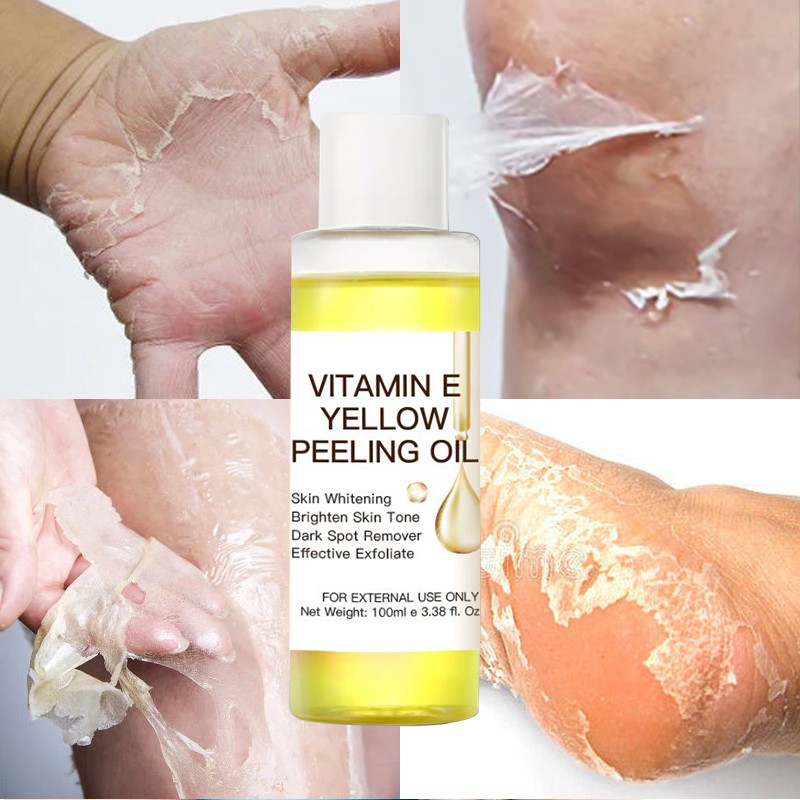 Factory Private Label Yellow Peeling Oil Vitamin C Knuckle Whitening Moisturizing Dark Spot Removal Extra Strength Peeling Oil