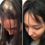 Private Label OEM 100% Natural Formula Wholesale Nourishing Hair Care Loss Treatment Hair Growth Oil Serum