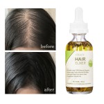 Private Label OEM 100% Natural Formula Wholesale Nourishing Hair Care Loss Treatment Hair Growth Oil Serum