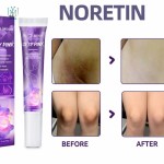 Hot Sexy Pink Private Parts pink Serum Whitening Cream Remove Melanin Lips Areolas for Women