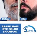Hot Sale Product Mens Beard Dye  Gradually Colors Mustache and Beard, Leaves Facial Hair Softer and Fuller