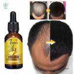 OEM/ODM私人标签支持健康的头发，稀疏的头发生长油，女性和男性10ML 20Ml 40ML