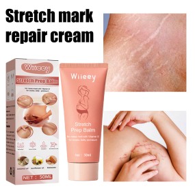 Herbal Effective Acne Pimple Mark Stretch Marks Scar Removing Cream High Effective Skin Repairing Gel