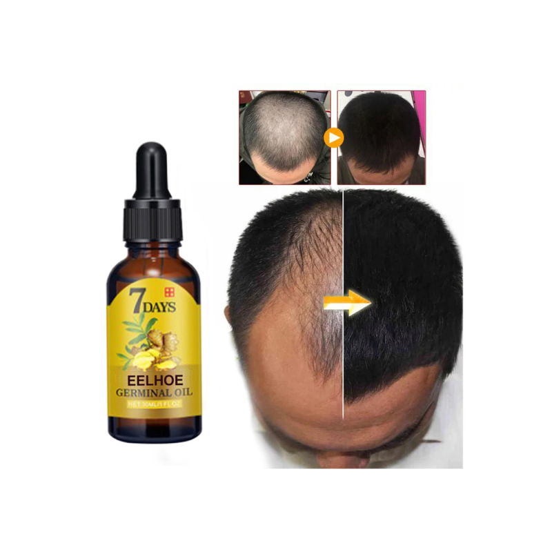 Rapid Dense Hair Growth Serum 7 Days Hair Growth Essence Oil Care Growth Ginger Essential Oils for Hair Care
