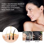 Hair Dense Essence to Strengthen Hair Roots, Nourish Hair Root, Strengthen Hair