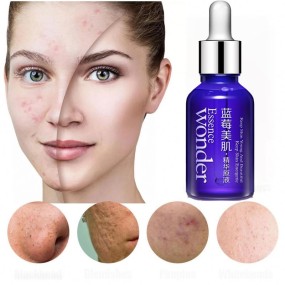 OEM BIOAQUA私人标签批发精华油血清抗衰老痘印清洁有机草药美白面部精华液