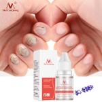 New Arrival Plant Extract Lavender Nail Growth Oil Lavender Fungal Nail Treatment Essential Oil Set Nail Protector Products