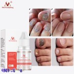 New Arrival Plant Extract Lavender Nail Growth Oil Lavender Fungal Nail Treatment Essential Oil Set Nail Protector Products