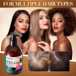 SADOER Shampoo, Cleansing, Anti-dandruff Foam and Anti-hair Loss Shampoo