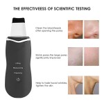 电子洗面奶铲超声波洗面奶去皮黑头去皮按摩器