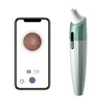 AI智能专业电动面部黑头去除仪USB充电防水手持工具包具有面部