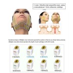Face Lifting Machine - OEM 12D Professional Device