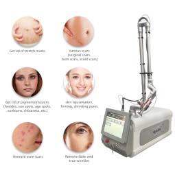 CO2 Laser Machine - OEM Portable Home Use Device