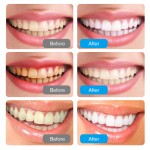 Toothpaste Manufacturer - OEM Bamboo Charcoal Whitening Gel Care