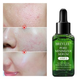 Acne Treatment Serum Factory - BREYLEE Natural Facial Essence Scar Removal