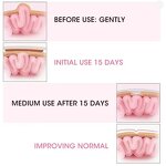 Newborn Hernia Belt Manufacturer - OEM Infant Navel Support Belt