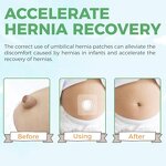 Baby Navel Patch Factory - OEM Waterproof Cotton Hernia Patch