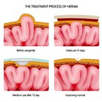 Baby Hernia Patch Supplier - OEM Waterproof Cotton Navel Patches