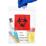 Biohazard Specimen Bag Factory - Custom Printed Transparent LDPE Bag