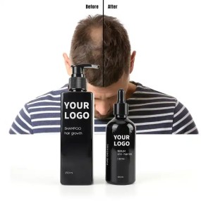 Hair Growth Oil Serum Supplier - Bulk Oil Control Natural Regrowth Treatment