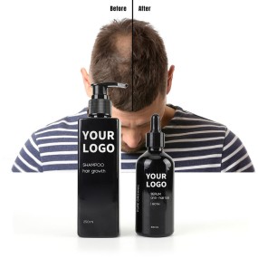 Professional Shampoo Supplier - OEM Organic Natural Ginger for Hair Care