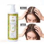 Thickening Shampoo Supplier - OEM Biotin Ginger Collagen Anti-loss