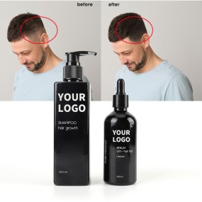 Hair Loss Serum Factory - Bulk Custom Label Repair Biotin Regrowth