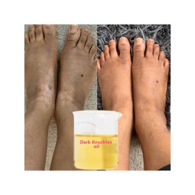 Skin Whitening Oil Manufacturer - Bulk Herbal Bleaching African Skin Peeling