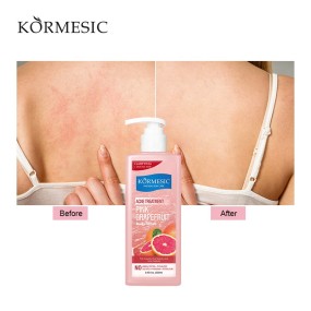 Ceramide Body Wash Supplier - OEM Skin Flower Moisturizing Whitening Grape