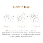Acne Treatment Serum Factory - OEM Scar Removal Cream