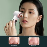 黑头去除器源头工厂 - 痘痘吸除毛孔清洁器代工