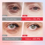 Eye Cream Factory - OEM Lycium Barbarum Firming